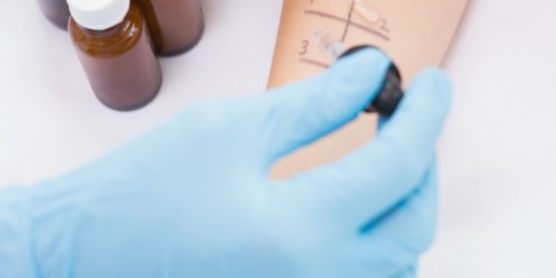 Four Ways Doctors Can Diagnose An Allergy